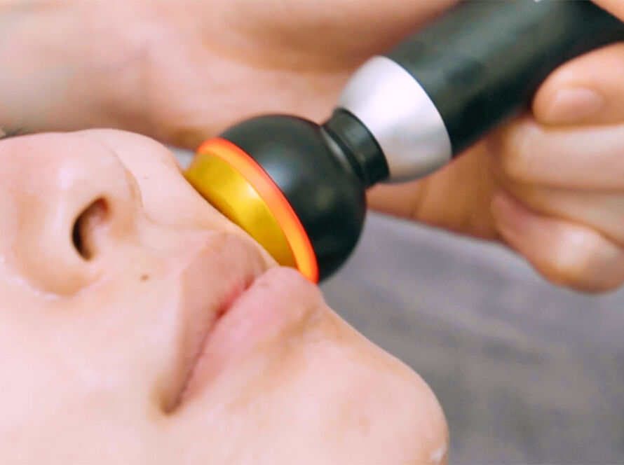 Anti-Wrinkles RF Treatment 1280x720 Image