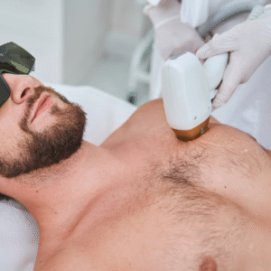 SHR Hair Removal (Chest)