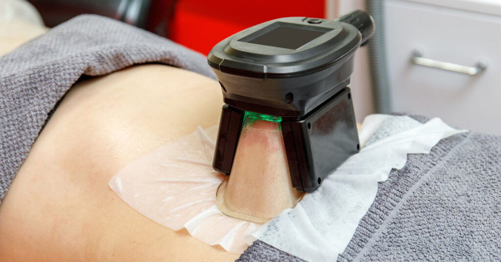 How Does Cryolipolysis Work? A Guide to Fat Freezing