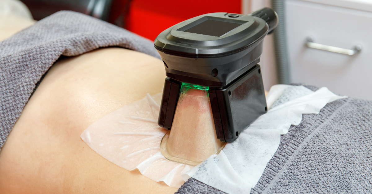 How Does Cryolipolysis Work? A Guide to Fat Freezing
