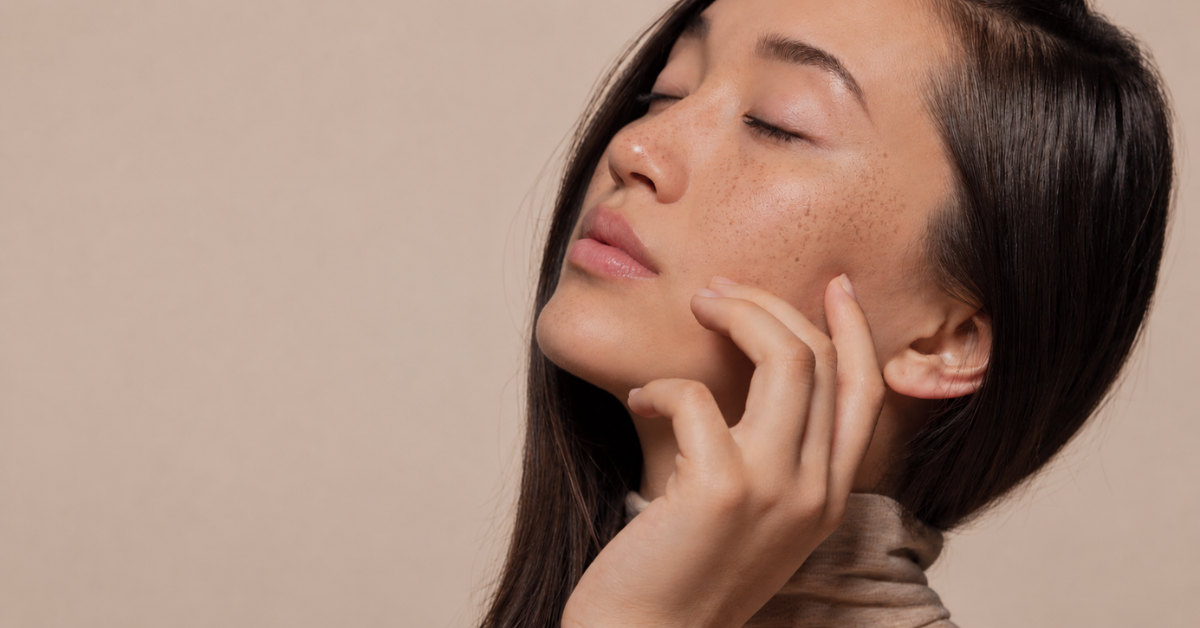 Melasma After Pregnancy: Why It Gets Worse and How Mums Can Manage It