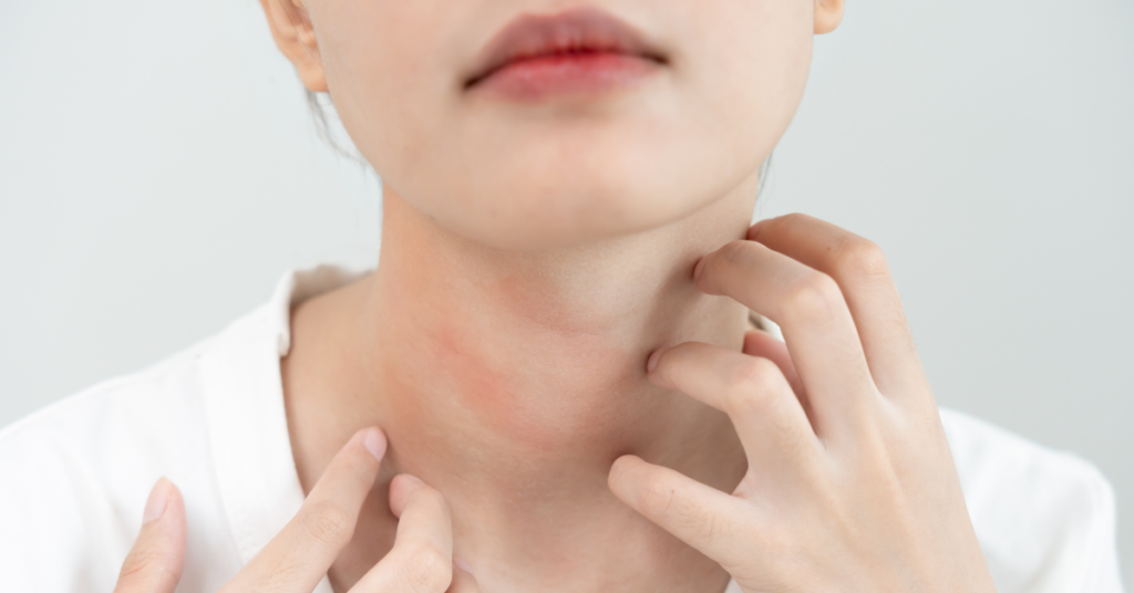 Skincare for Haze Season in Singapore: How to Protect Your Skin From Pigmentation and Sensitivity