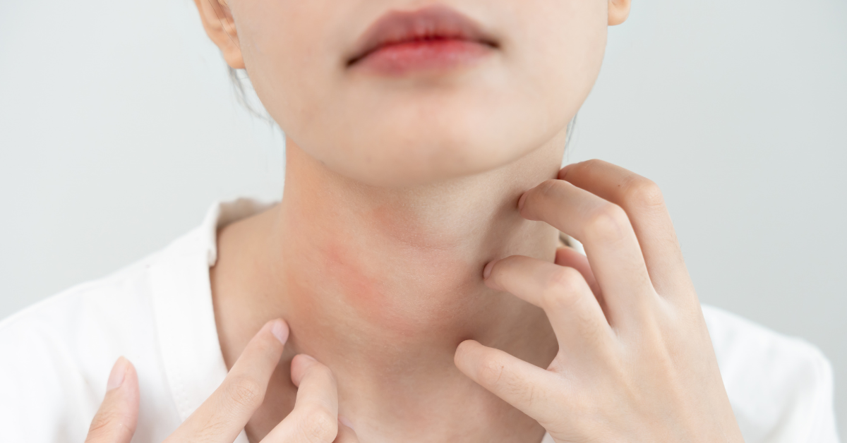 Skincare for Haze Season in Singapore: How to Protect Your Skin From Pigmentation and Sensitivity