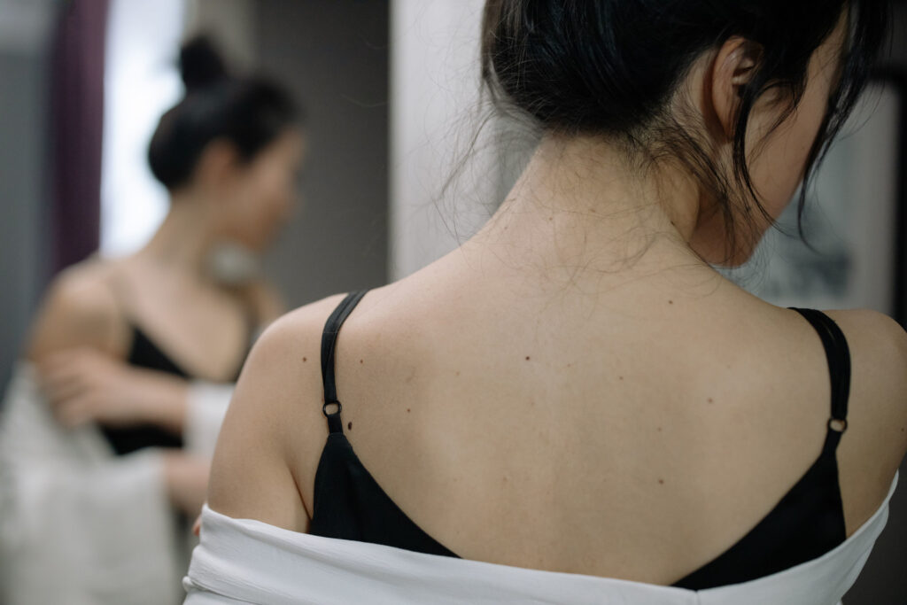 What Causes Back Acne in Singapore's Air-Conditioned Offices, and How to Manage It