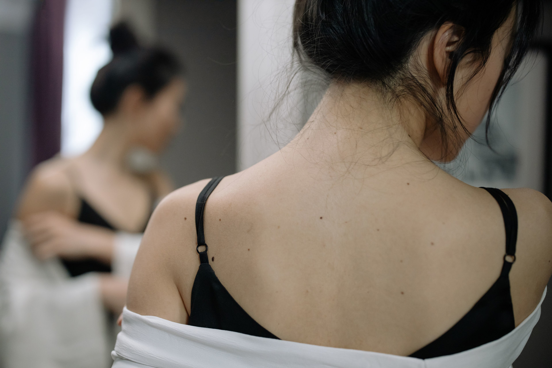 What Causes Back Acne in Singapore's Air-Conditioned Offices, and How to Manage It